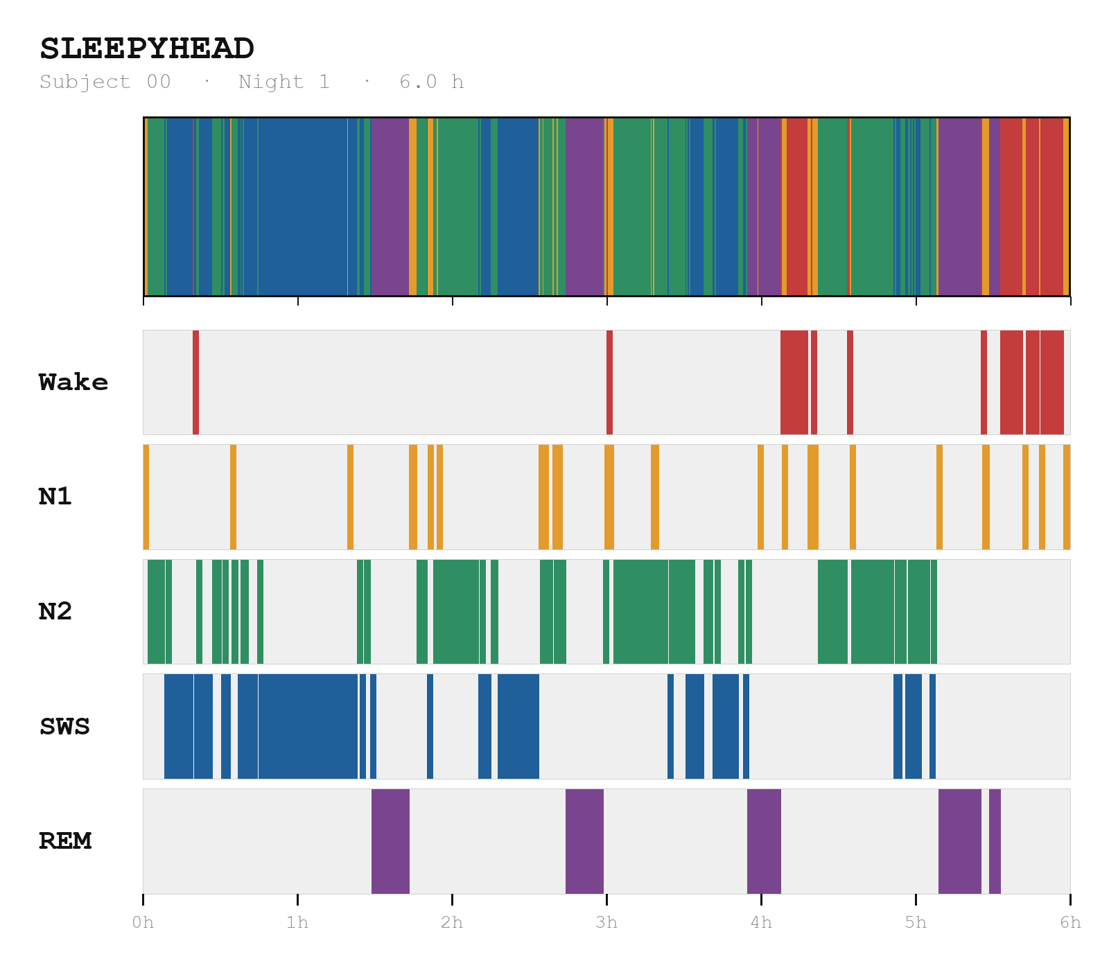 Sleepyhead sleep-stage hypnogram